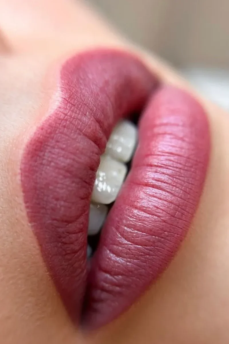 IMG-81aff75704cab51ffe4d02fbb4f9fae9-V