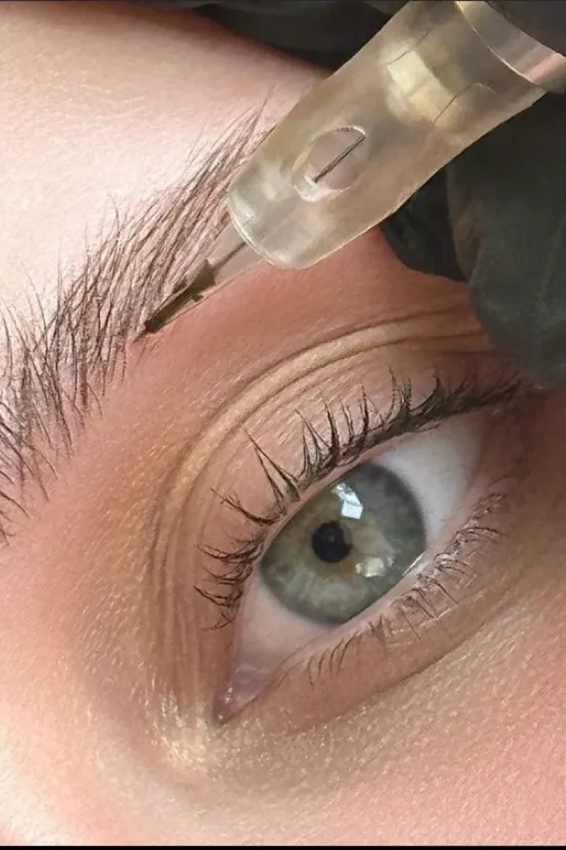 IMG-ddf542b27af596075b02f8b3f8e07d2c-V